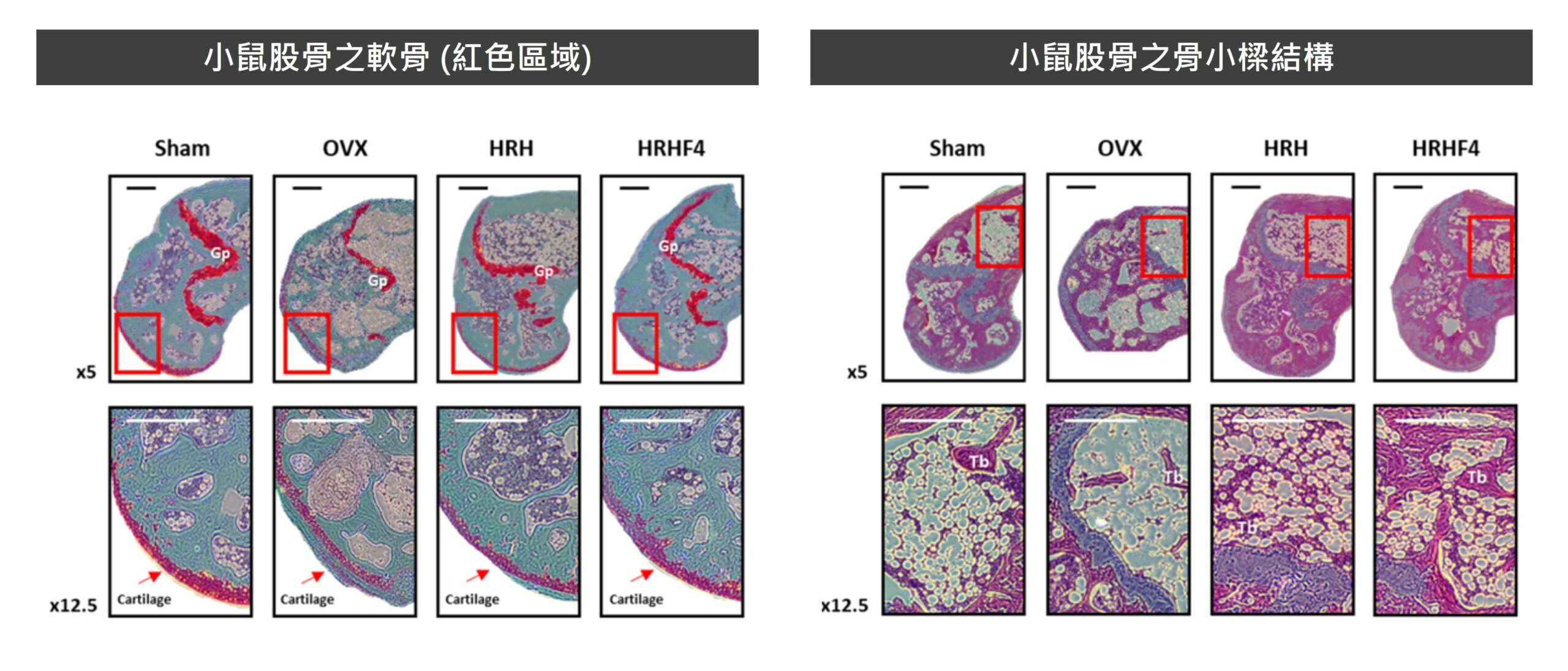 沙棘能夠恢復更年期骨質流失與骨骼結構
