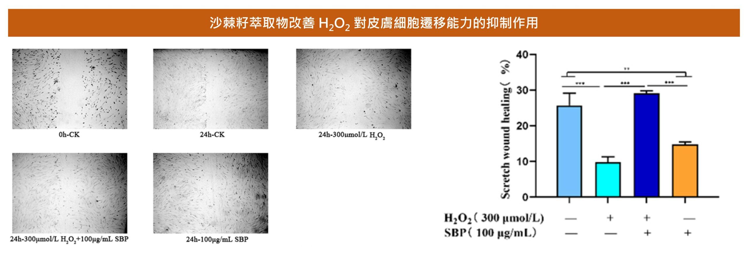 沙棘籽萃取物能夠促進皮膚細胞遷移,增進傷口修復